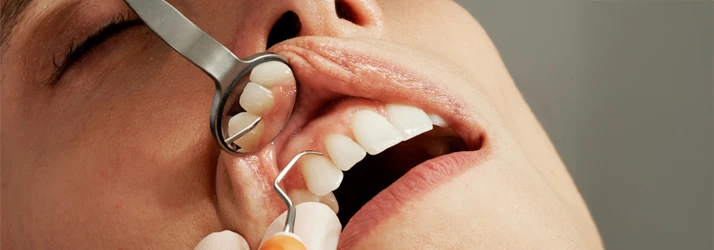 FC – Advanced Periodontist Care at Great Smile Dental, CA FC – Advanced Periodontist Care at Great Smile Dental, CA