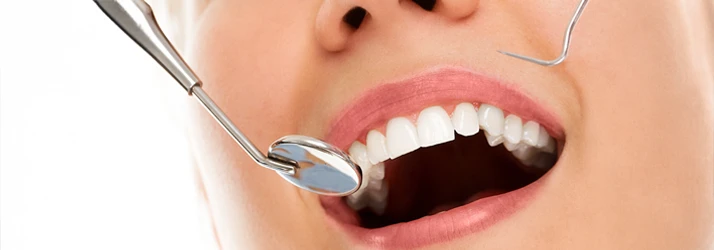 FC – Specialized Teeth Cleaning Tailored to Your Needs FC – Specialized Teeth Cleaning Tailored to Your Needs